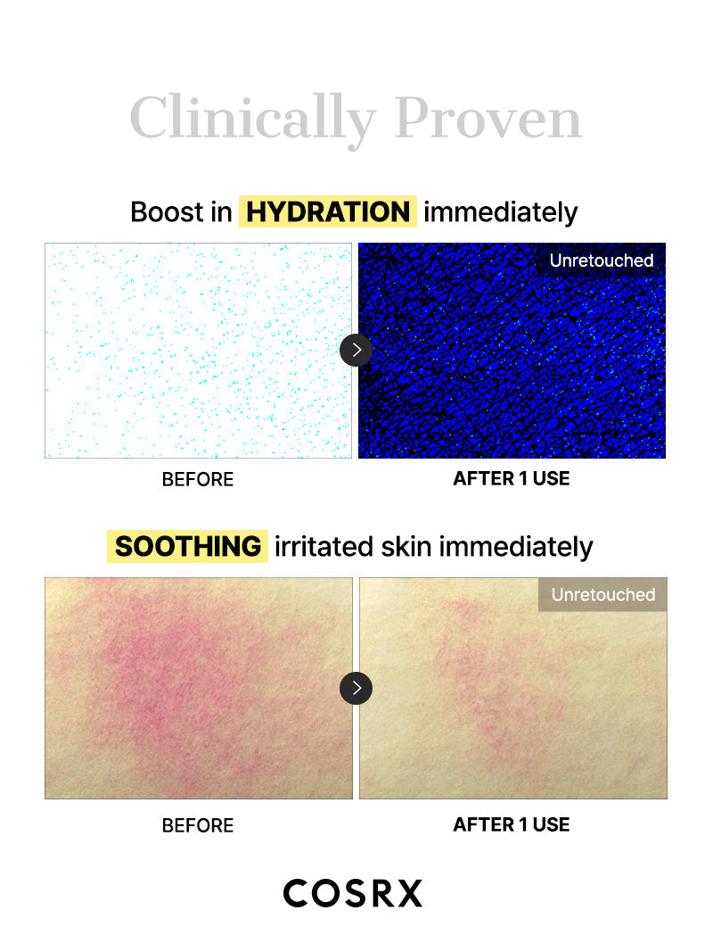 Advanced Snail Mucin Glass Glow Hydrogel Mask_3ea