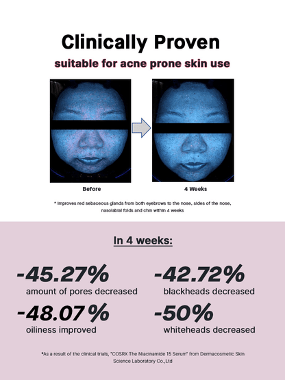 The Niacinamide 15 Serum